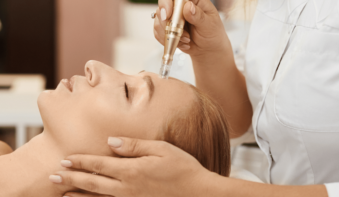 Kopie von Microneedling