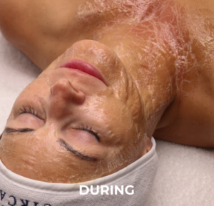 image with 2 faces. left ist before the treatment and right is after the treatment